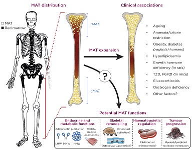 The anatomical distribution, clinical associations and potential functions of bone marrow adipose tissue (MAT). The image of the skeleton is adapted from Kricun (1985).16 cMAT, constitutive MAT; rMAT, regulated MAT; TZD, thiazolidinediones; FGF21, fibroblast growth factor 21; LMW/MMW/HMW, low/medium/high molecular weight. Kricun ME 1985 Red-yellow marrow conversion: its eﬀect on the location of some solitary bone lesions. Skeletal radiology 14(1), pp. 10–19. &#169;International Skeletal Society 1985. With permission of Springer.