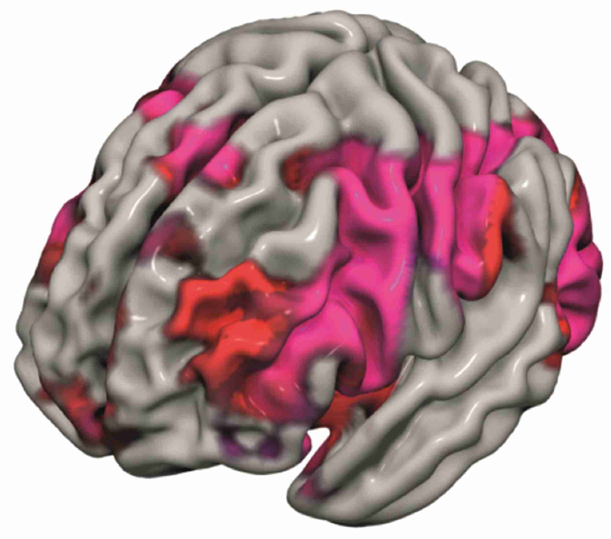 Figure 4. Kisspeptin enhances sexual and emotional brain processing. &#169;A Comninos and W S Dhillo