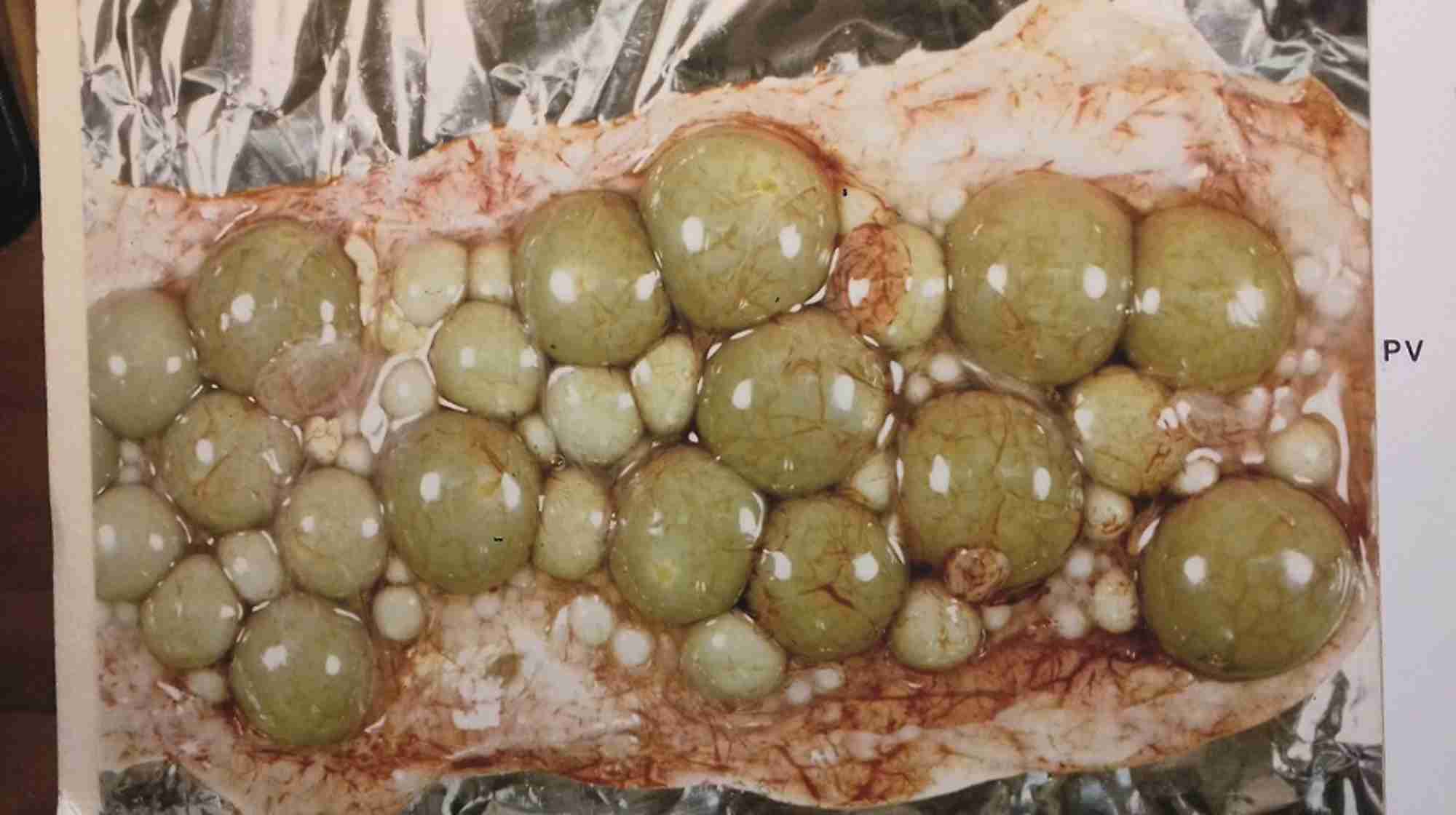 The dogfish ovary. Hundreds of oocytes are visible. PV is an area of previtellogenic follicles (no yolk and &lt;7mg) many of which later become vitellogenic and filled with green-yellow yolk (2.5-3.0 g). POF indicates a post-ovulatory follicle with only the blood vessels remaining visible. YP are even older atretic follicles from the previous reproductive season. @January 1977, MHI Dodd