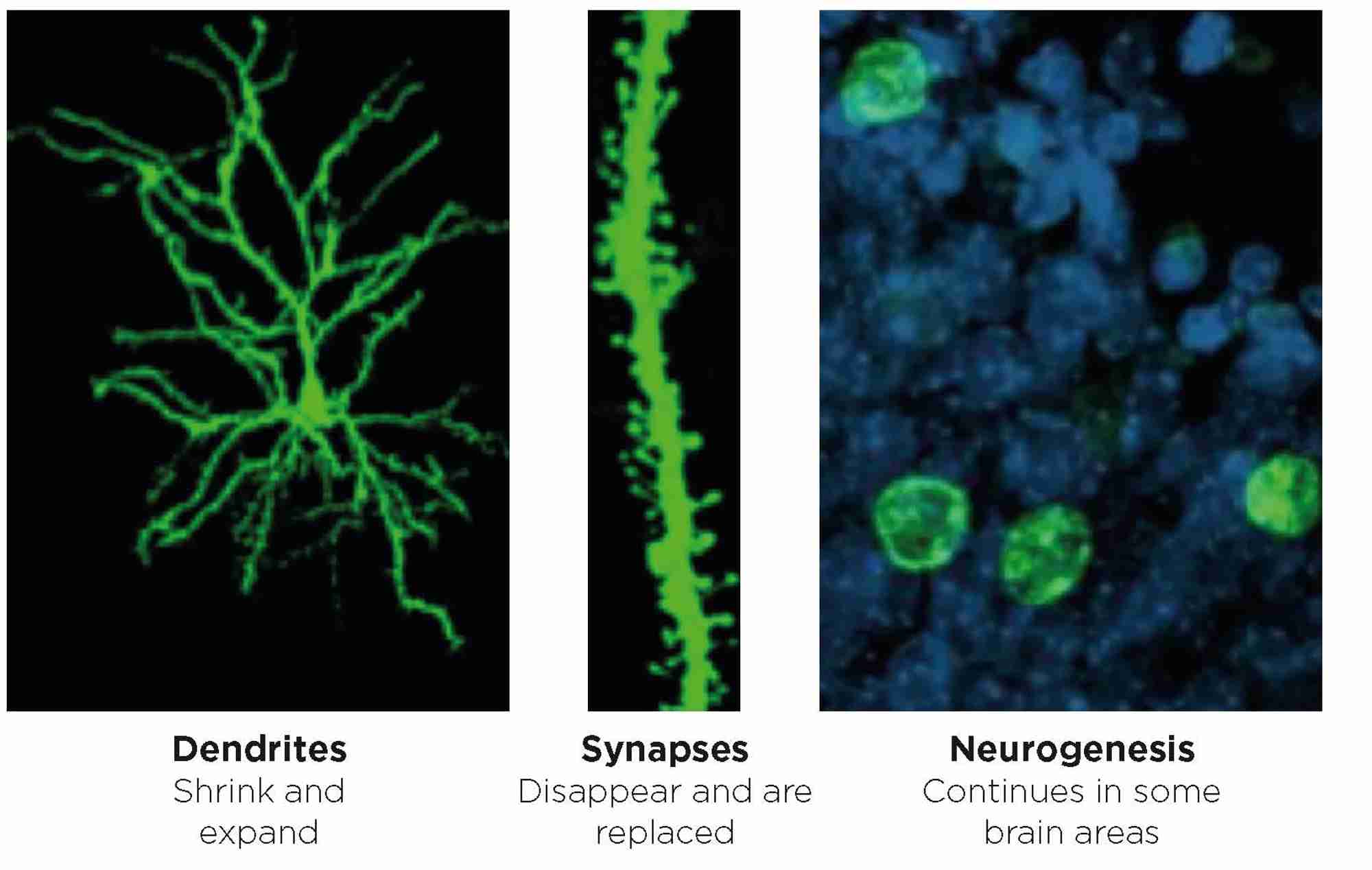 Figure 3. Hormones are involved in regulating brain architecture that includes remodelling of dendrites, turnover of synapses and neurogenesis in the adult as well as in the developing brain. &#169;E Gould, Princeton University