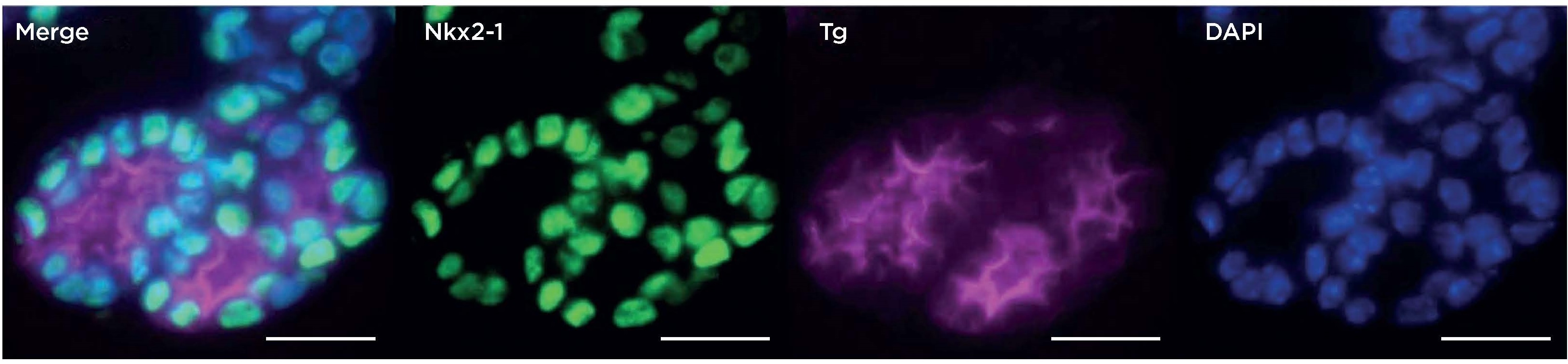 In vitro development of ESC-derived thyroid follicular cells by directed differentiation: immunofluorescence microscopy of day 30 follicular-like structures after immunostaining for Nkx2-1 and thyroglobulin (Tg). Nuclei are counterstained with DAPI; scale bars 10µm. Reproduced with permission from Figure 5F, Kurman et al. 2015 Cell Stem Cell 17 527 542