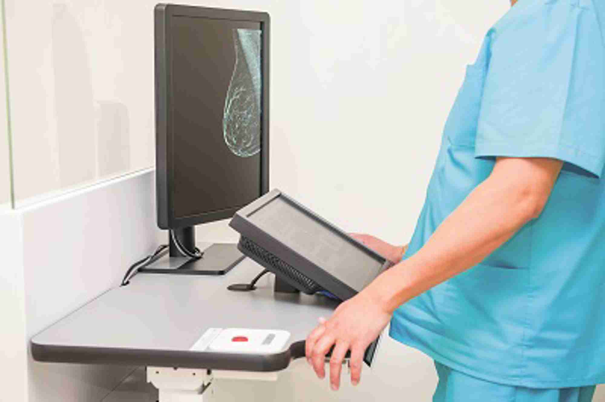 p4-5 mammogram.jpg