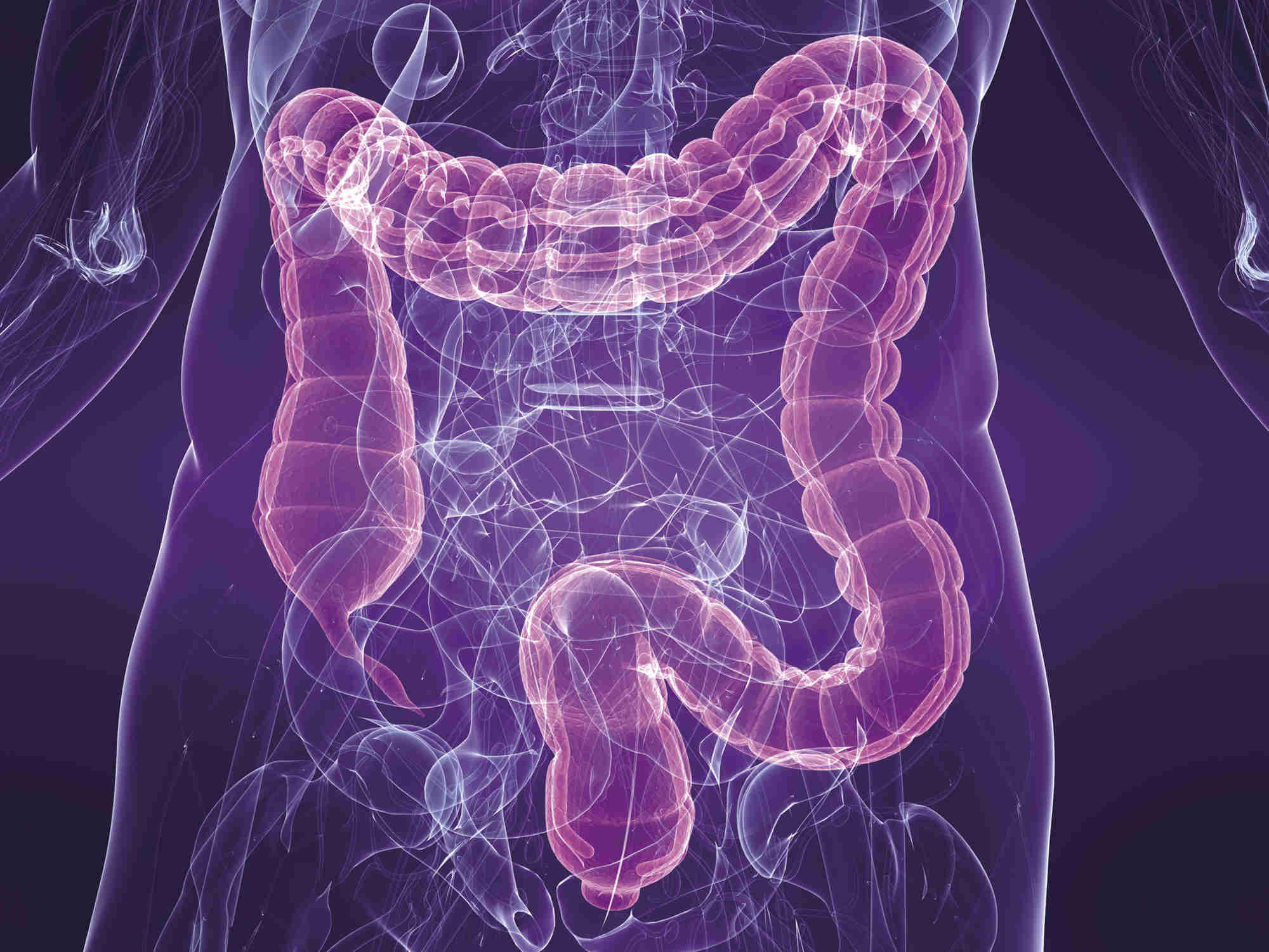 P4 Colon image.jpg