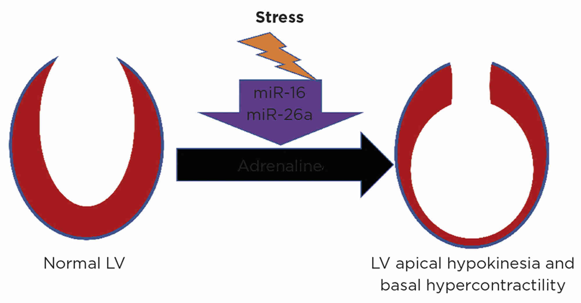 Figure. Prior stress may predispose to future TTS. Representation of the left ventricle (LV) showing TTS, with contractile dysfunction following adrenaline made more likely by prior neuropsychiatric stress. Reproduced under CC BY 4.0 Licence (http://creativecommons.org/licenses/by/4.0) from Couch et al.10 https://doi.org/10.1093/cvr/cvab210 &#169;2021 The Authors