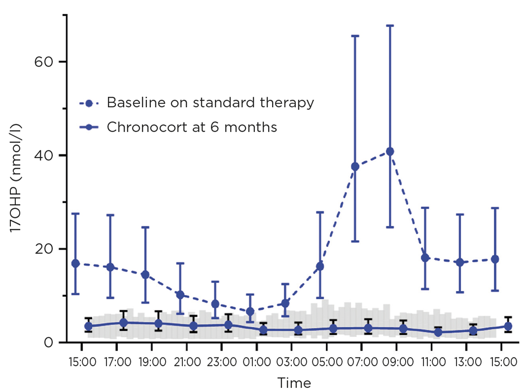 Figure 2. 17OHP at baseline on standard treatment (dashed line), showing marked diurnal rhythm with high levels in the morning, and on Chronocort at 6 months (solid line), showing that Chronocort treatment normalises 17OHP levels. Grey shaded area is 17OHP in healthy controls. Reproduced in adapted form from Ghizzoni et al.10 by permission
