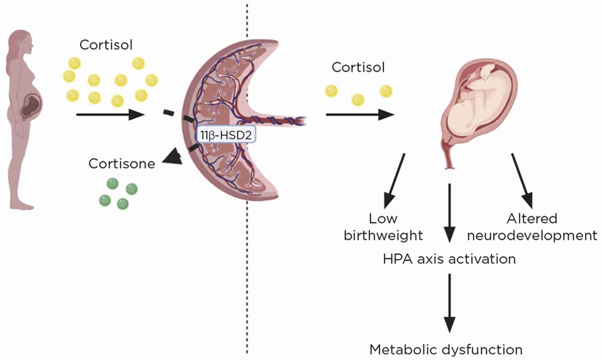 Maternal blood cortisol (yellow circles) reaches the placenta where it is partially metabolised by 11β-HSD2 into the inactive cortisone (green circles). An increase in cortisol transfer to the fetus (due to increased maternal levels, or reduced inactivation) results in low birthweight, long term activation of the HPA and alterations in development of the limbic system. This links the in utero environment with adult health and disease. Figure created with BioRender.com
